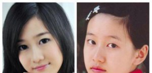 劉美含整容成“電眼”劉美含整容前后照