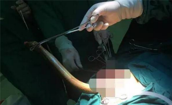 黃鱔門主播被刑拘 黃鱔門女主播琪琪：不知道這涉黃 2