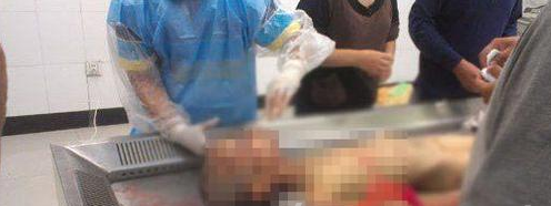 河南餓死男童被曝受虐 傷痕累累觸目驚心 4
