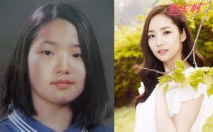 金娜娜整容前曝光 萬沒想到女神以前竟胖成這樣太難看了