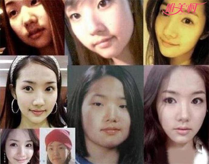 金娜娜整容前曝光 萬沒想到女神以前竟胖成這樣太難看了 2