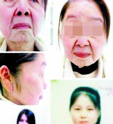 80后美女娩后“一夜變老” 生完孩子毀掉整個青春 6