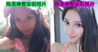快手兔仙被誰睡了 快手兔仙流出的不雅視頻是真的嗎 5