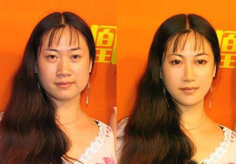 芙蓉姐姐整容了嗎 芙蓉姐姐整容前后對比照片 3