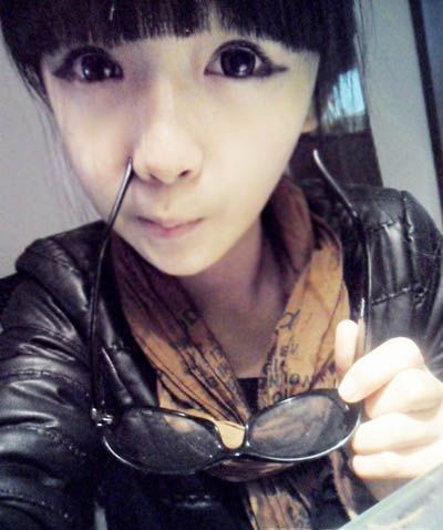 張依依被打后的照片 張依依為什么被打 2