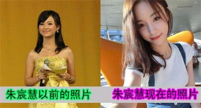 扒皮雪梨小矮人成名史 朱宸慧整容前后照片 6
