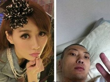 李斯羽事件是什么 李斯羽整容后遺癥 3