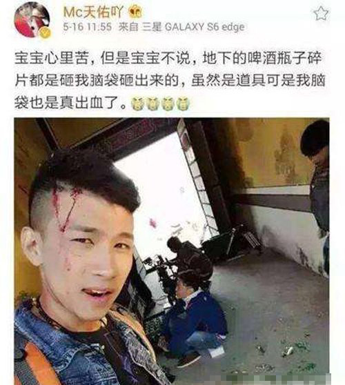 天佑在唐山酒吧被打為什么 mc天佑被打照片 4