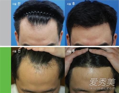 男士寸頭發(fā)型圖片2020 多短的頭發(fā)才叫寸頭？ 14