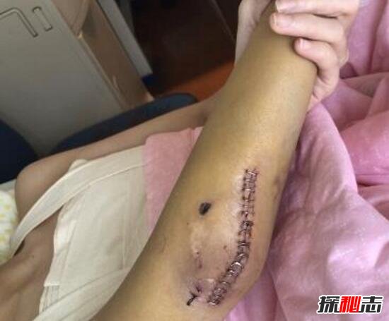 yy夏可可車禍事件 主播秦始皇不幸離世 5