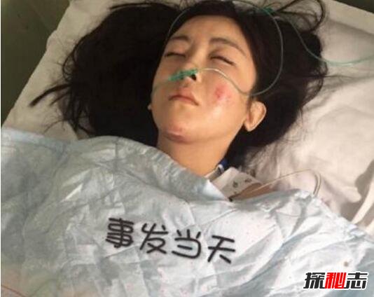 yy夏可可車禍事件 主播秦始皇不幸離世 7