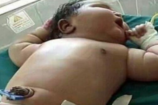 世界上最重的女嬰兒 生下來(lái)沒(méi)有任何的疾病 4
