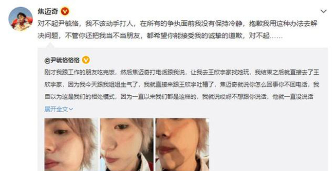 周深尹毓恪誰厲害 尹毓恪真的能與周深比嗎 2