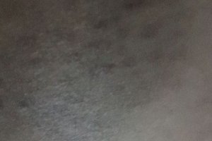 拍出痧的顏色代表什么 拍痧顏色癥狀對照表