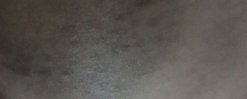 拍出痧的顏色代表什么 拍痧顏色癥狀對(duì)照表 1