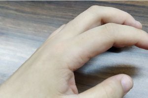 指甲剪太短疼怎么辦 指甲剪太短了怎么補救