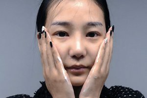 切眉會加速衰老嗎 為什么切眉手術(shù)老得快
