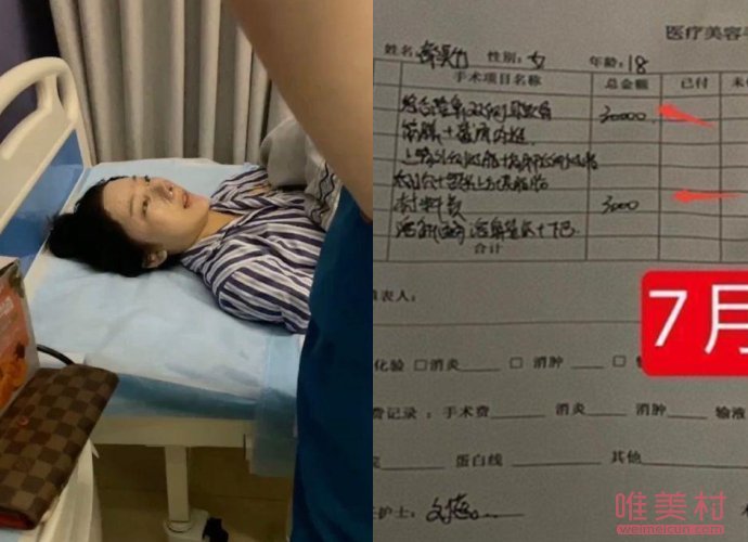網紅都美竹整容前照片 被閨蜜曝光整容照 2