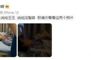 網紅都美竹整容前照片 被閨蜜曝光整容照