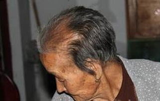老人長(zhǎng)黑頭發(fā)預(yù)示什么 老年人白發(fā)變黑發(fā)征兆 1