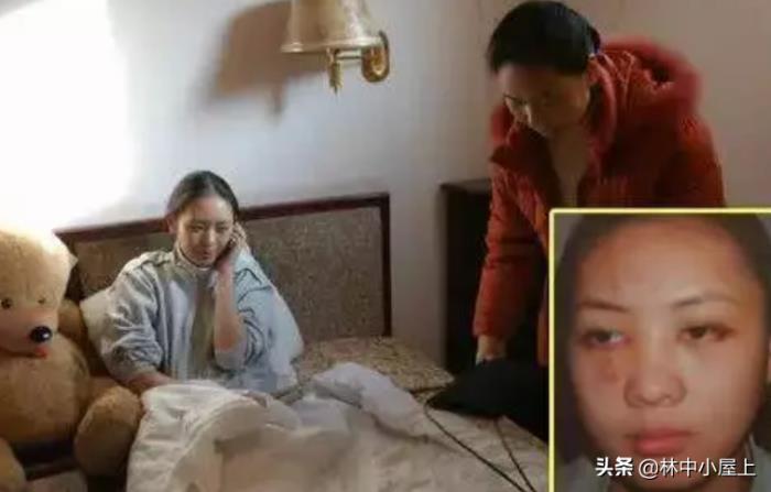 張默打童瑤到底真相 張默當年為什么打童瑤 2