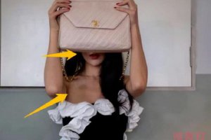 吳速玲曬淤青照 暗示被老公曹格家暴了