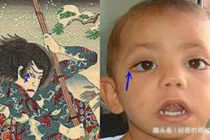 歌舞伎面譜綜合癥小女孩 為什么會長得漂亮？