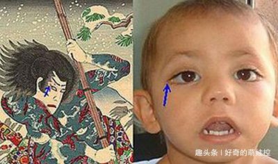 歌舞伎面譜綜合癥小女孩 為什么會長得漂亮？ 1