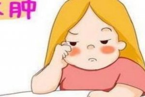 皮膚出現水腫的原因