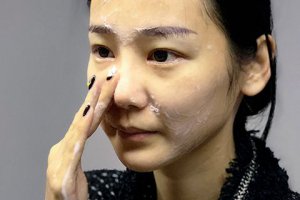 臉上油膩頭發(fā)油膩是不是濕氣重