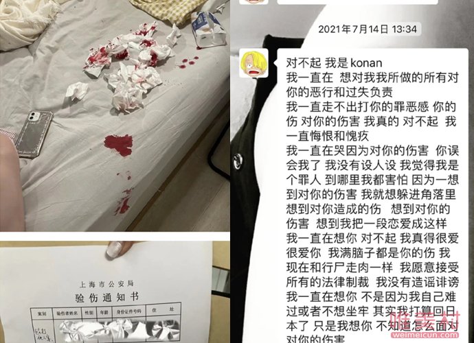 非正式會談7日本代表金子浩拓 被控訴家暴吃軟飯 2