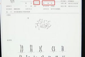 男子婚檢報(bào)告顯示為女性 引來了不少網(wǎng)友的吐槽