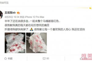 抖音網紅abbily變性了嗎 Abbily自曝變性后遺癥