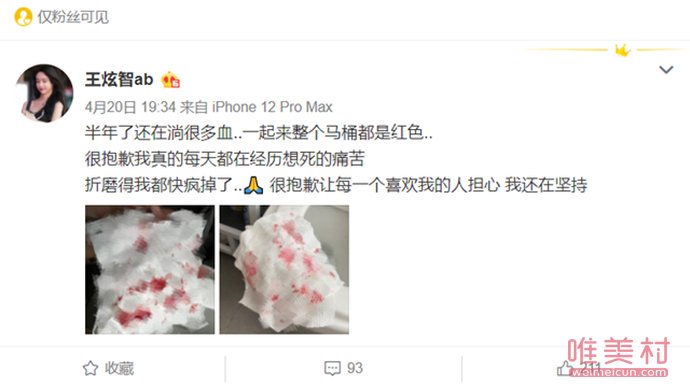 抖音網紅abbily變性了嗎 Abbily自曝變性后遺癥 1