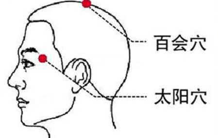 偏頭痛的中醫(yī)治療方法怎么樣 偏頭痛中醫(yī)中藥治療 1