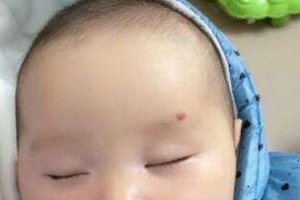 神仙轉世胎記的位置大全 神仙下凡的標志
