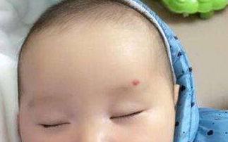 神仙轉(zhuǎn)世胎記的位置大全 神仙下凡的標(biāo)志 1