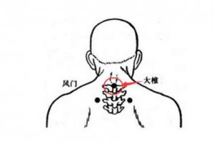 風寒感冒艾灸大椎穴效果較好