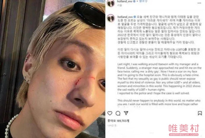 韓國首位出柜男歌手holland 被罵是骯臟的gay怎么回事 1