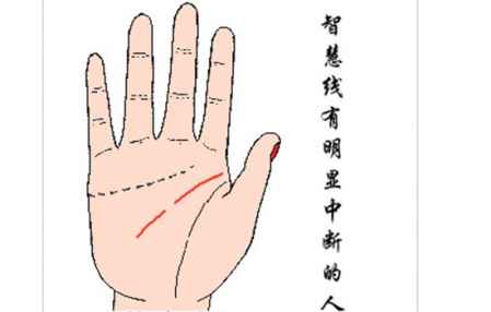 智慧線斷開什么意思 提前做好災難化解 1