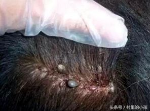 頭上長虱子是什么原因引起的 2